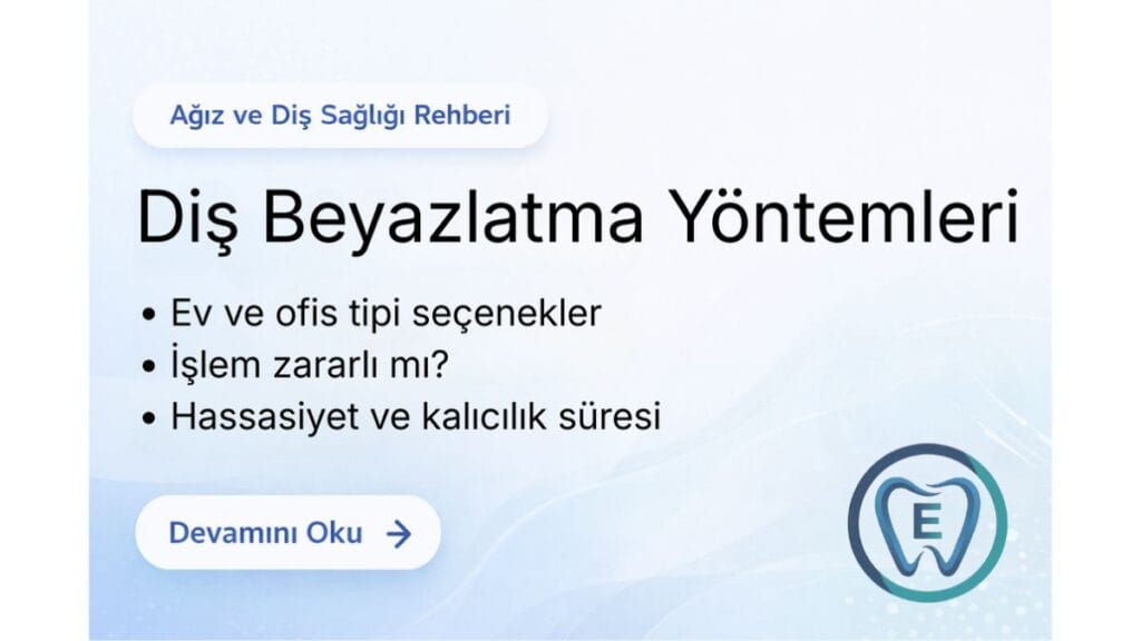 Sakarya Elbirlik Diş Kliniği tarafından hazırlanan ev ve ofis tipi diş beyazlatma yöntemleri hakkında genel bilgilendirme içeren rehber görseli.