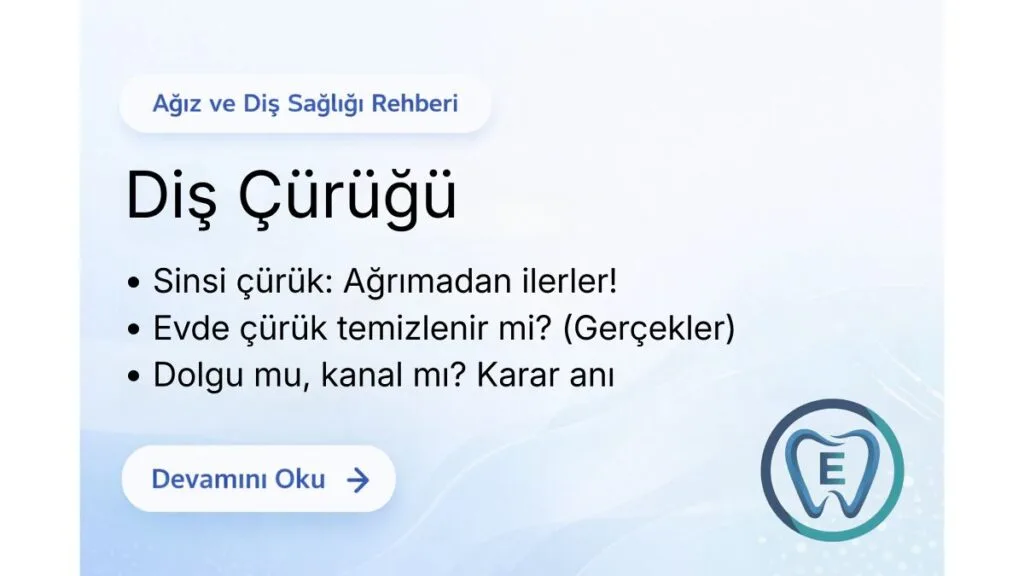 Sakarya Elbirlik Diş Polikliniği tarafından hazırlanan diş çürüğü belirtileri, ağrısız ilerleyen çürükler ve koruyucu diş hekimliği yöntemleri hakkında bilgilendirme görseli.
