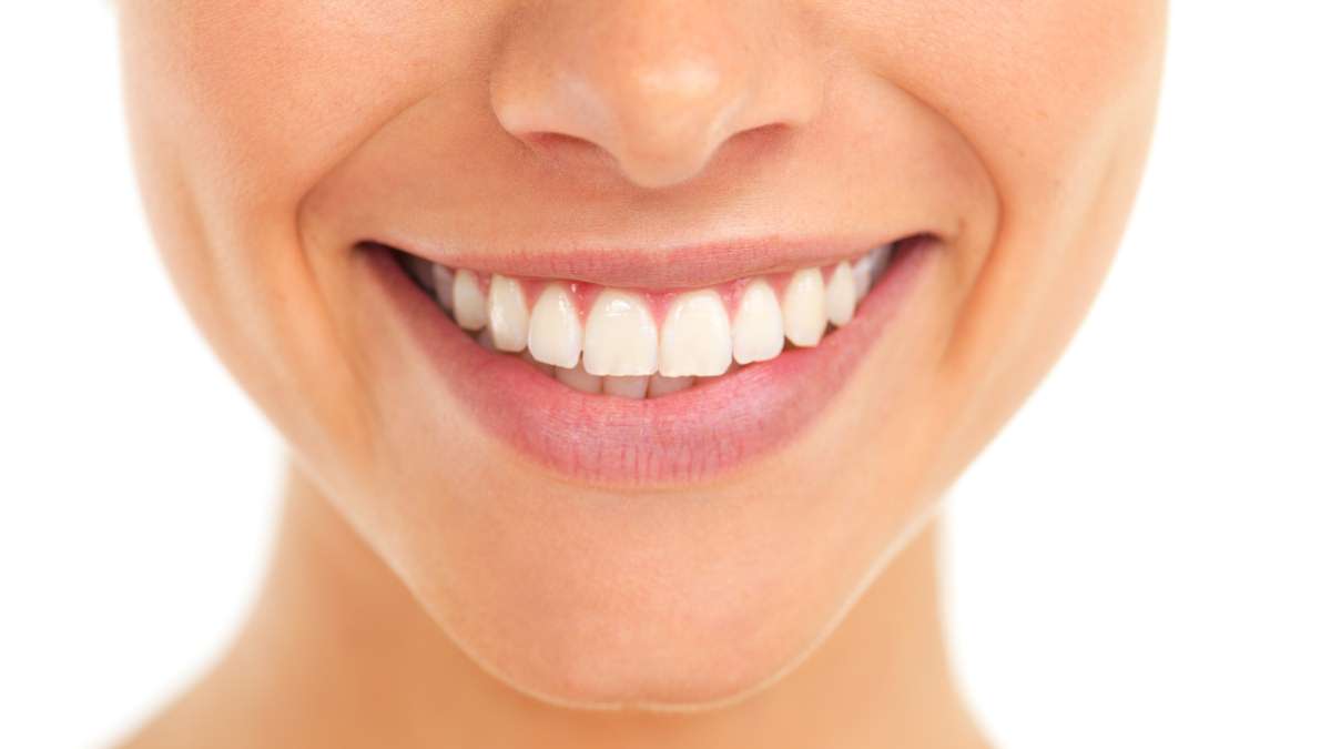 Sakarya estetik diş hekimliğinde beyazlatma sonrası doğal ve parlak gülüş