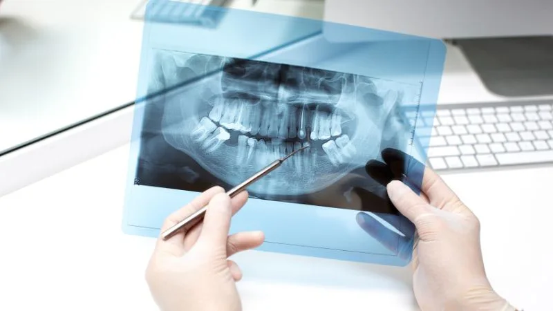 Diş hekimi 3D CBCT tomografi taramasını incelerken ve implant planlaması yaparken