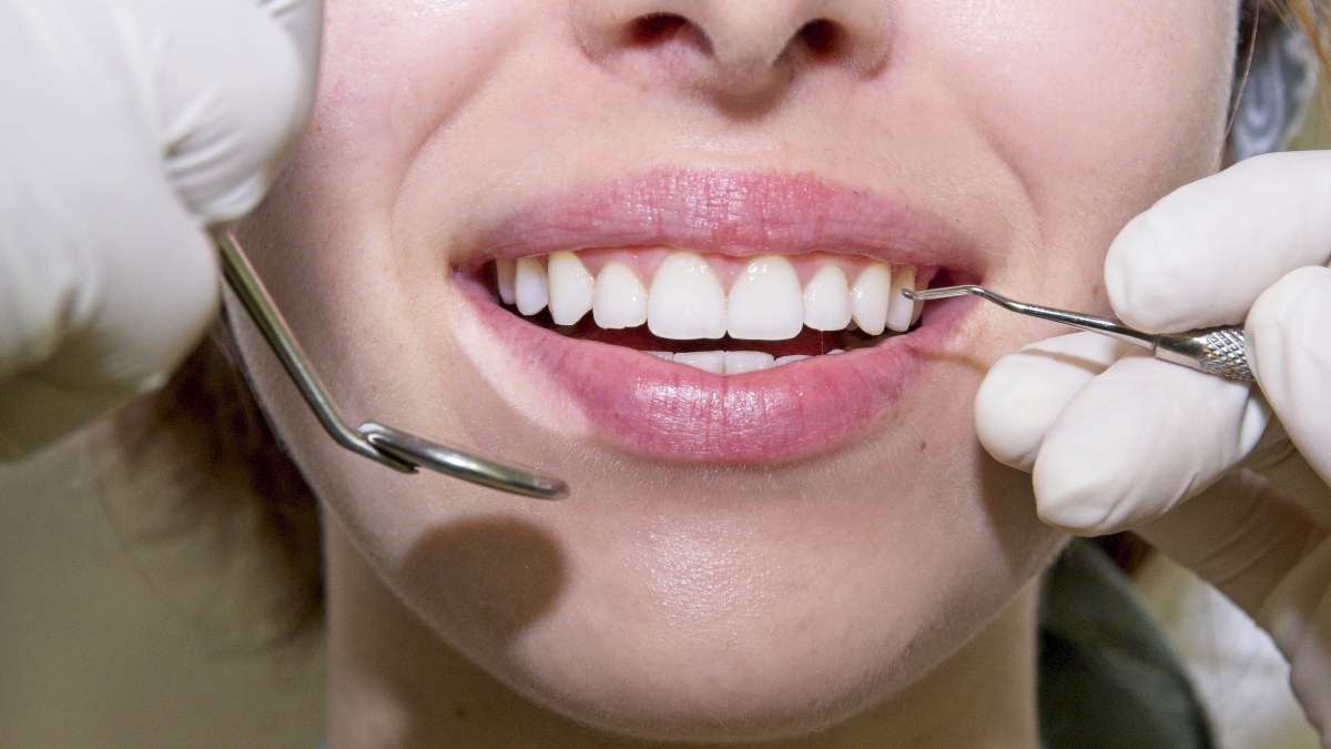 Sakarya diş kliniğinde temizlik sonrası diş kontrolü yaptıran hasta