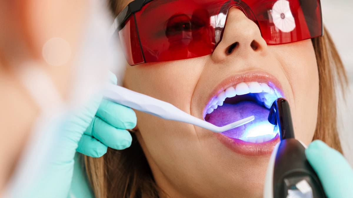 Sakarya diş kliniğinde mavi ışık teknolojisi ile uygulanan estetik kompozit dolgu