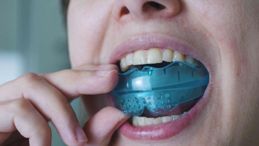 Sakarya diş kliniğinde bruksizm (diş sıkma) tedavisi için kullanılan, dişlere tam uyumlu şeffaf ve sert gece plağını takan kadın hasta.