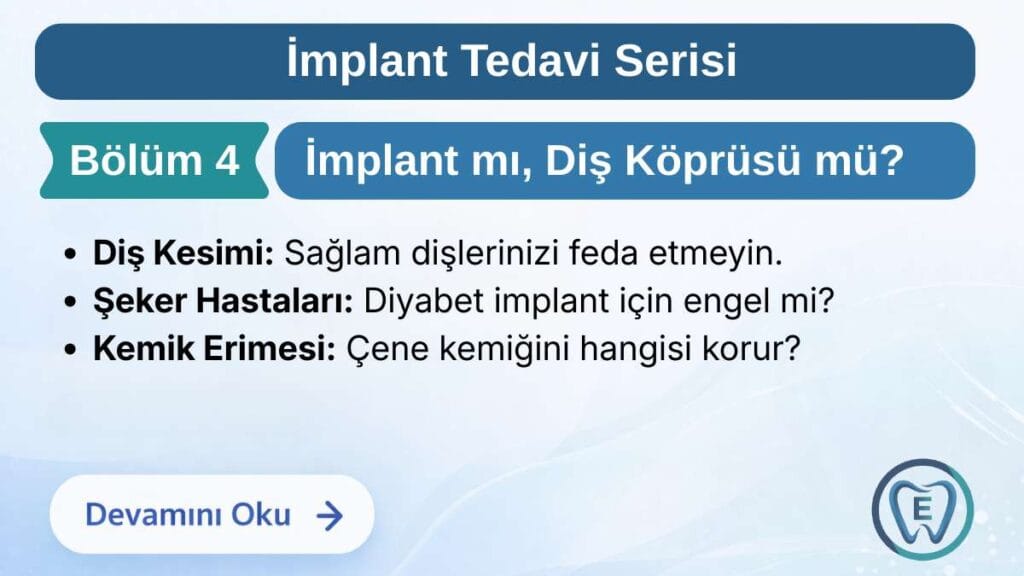 Sakarya Elbirlik Diş Polikliniği tarafından hazırlanan; diş eksikliklerinde implant ve diş köprüsü tedavisinin farkları, sağlam dişlerin kesilmesi, şeker hastalığı (diyabet) ve kemik erimesine etkilerinin karşılaştırıldığı bilgilendirme görseli.