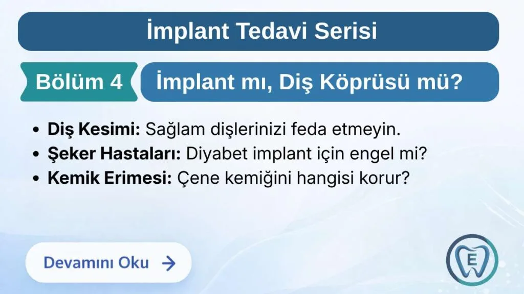 Sakarya Elbirlik Diş Polikliniği tarafından hazırlanan; diş eksikliklerinde implant ve diş köprüsü tedavisinin farkları, sağlam dişlerin kesilmesi, şeker hastalığı (diyabet) ve kemik erimesine etkilerinin karşılaştırıldığı bilgilendirme görseli.