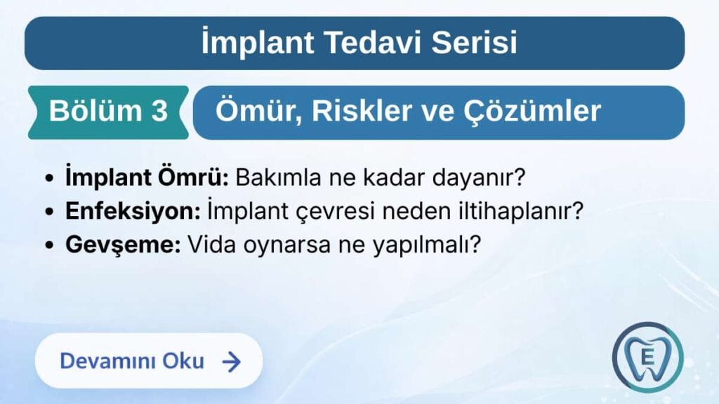Sakarya Elbirlik Diş Polikliniği tarafından hazırlanan; dental implantların kullanım ömrü, implant çevresi enfeksiyonu (peri-implantitis) nedenleri ve vida gevşemesi gibi teknik sorunlar hakkında bilgilendirme görseli.