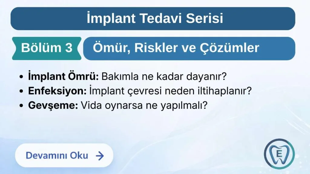 Sakarya Elbirlik Diş Polikliniği tarafından hazırlanan; dental implantların kullanım ömrü, implant çevresi enfeksiyonu (peri-implantitis) nedenleri ve vida gevşemesi gibi teknik sorunlar hakkında bilgilendirme görseli.
