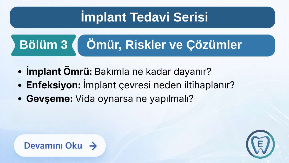 İmplant Tedavisinin Ömrü ve Olası Riskler