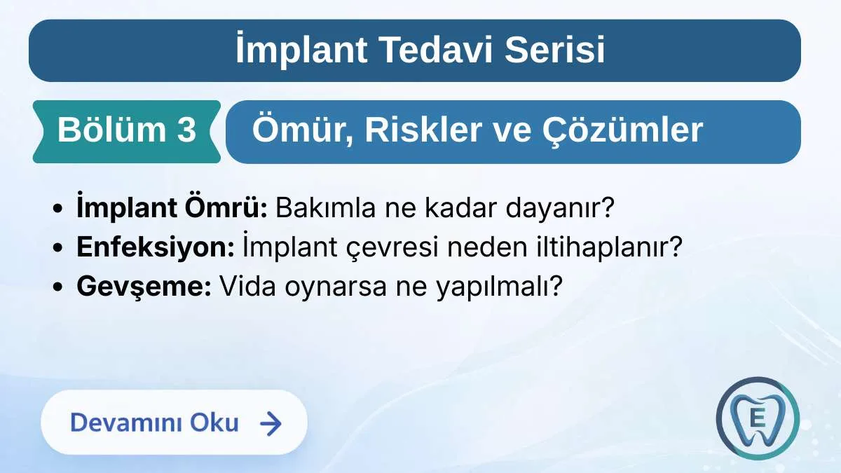 İmplant Tedavisinin Ömrü ve Olası Riskler