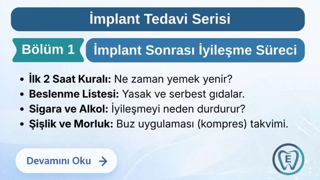 Sakarya Elbirlik Diş Polikliniği tarafından hazırlanan implant tedavisi sonrası ilk 48 saat bakımı, beslenme önerileri, buz kompres uygulaması ve iyileşme süreci rehberi görseli.
