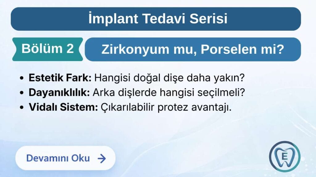 Sakarya Elbirlik Diş Polikliniği tarafından hazırlanan, implant üstü protezlerde zirkonyum ve metal destekli porselen dişlerin estetik, dayanıklılık ve vidalı sistem avantajlarına göre karşılaştırıldığı bilgilendirme görseli.