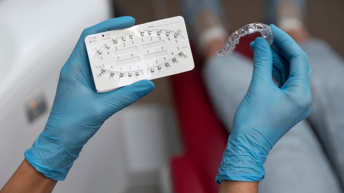 Sakarya ortodonti kliniğinde hekimin elinde tuttuğu geleneksel metal braket seti ve şeffaf plak telsiz tedavi örneğinin yan yana görünümü